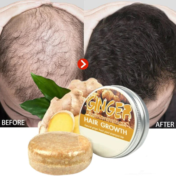 1+1 GRATIS | ReGrow™ Stimuleert haargroei, voorkomt haaruitval!